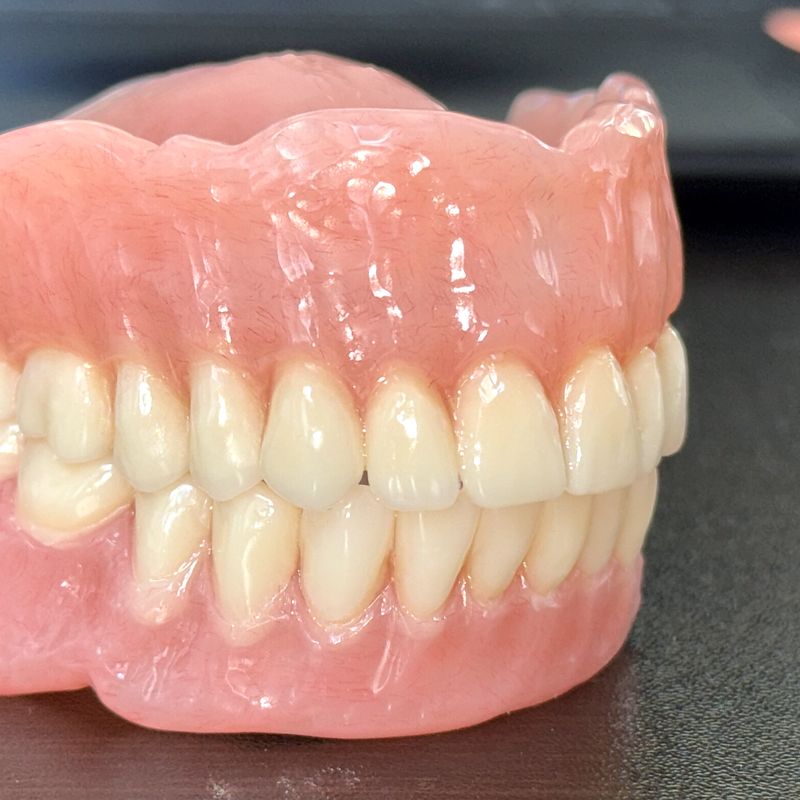 Complete upper and lower dentures